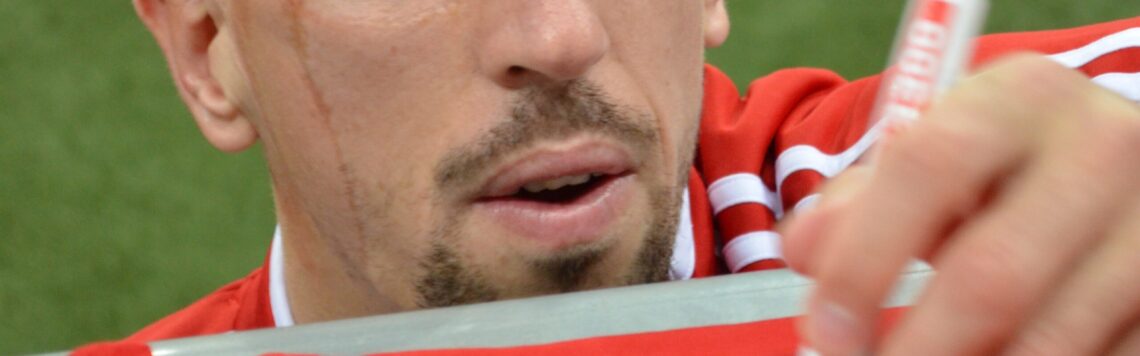 19. Januar | Tag 19 – Markus 11,9